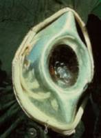 the black stone